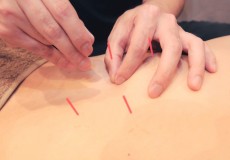 腰痛（ぎっくり腰）について